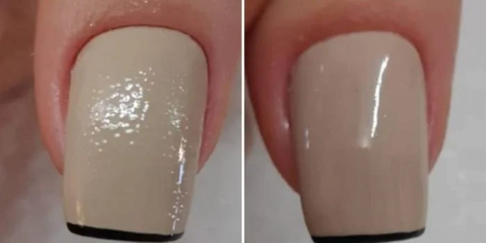 O que fazer quando dá bolinhas na